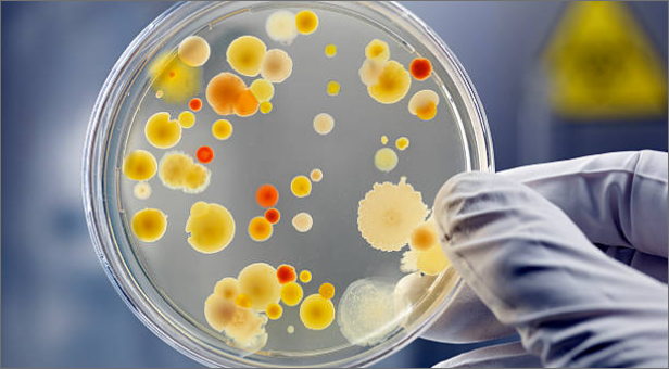 A gloved hand holding a petri dish with cultures in it